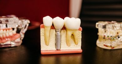 Dentist vs. Dental Hygienist